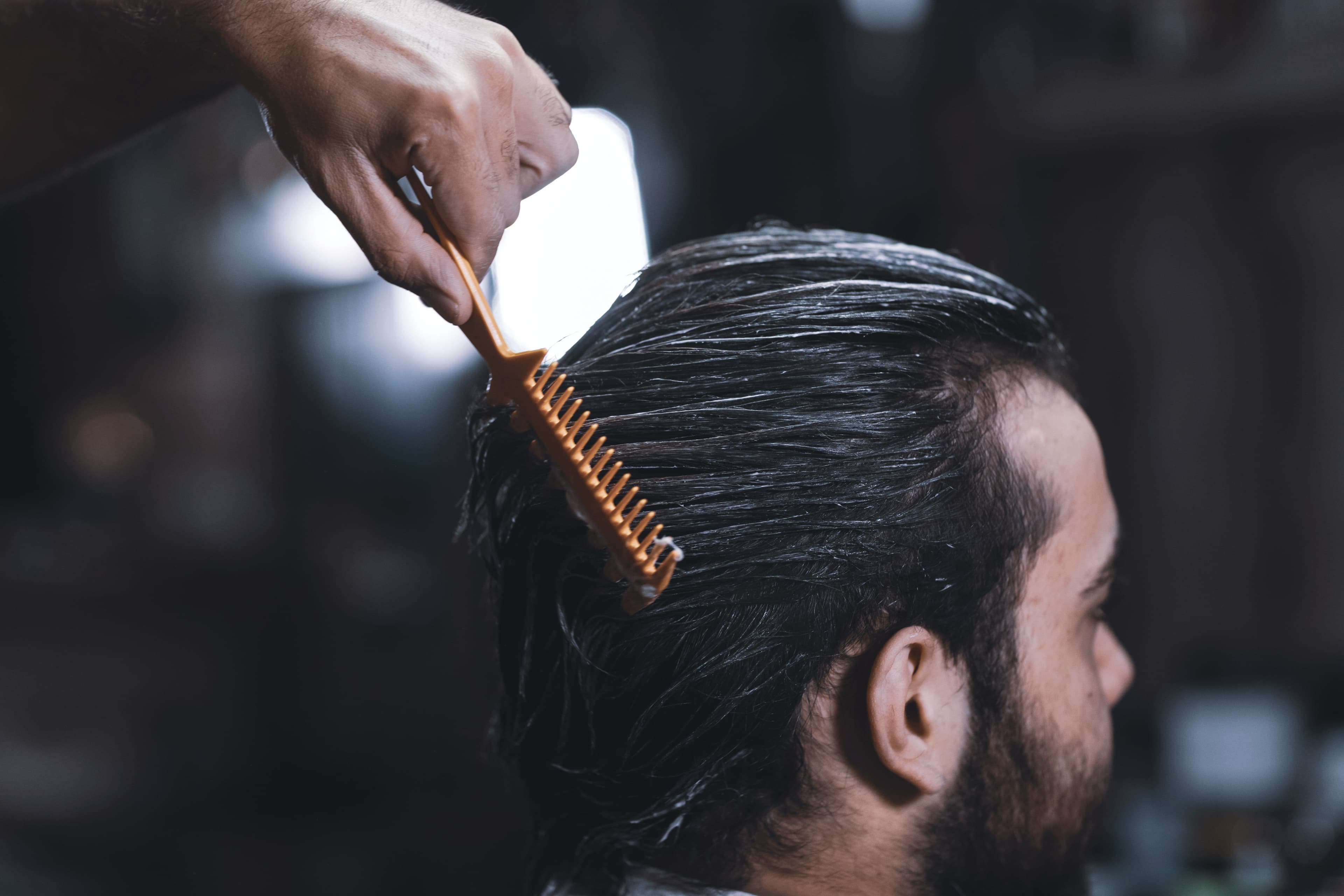 Does a Hair Transplant Hurt? What You Should Know