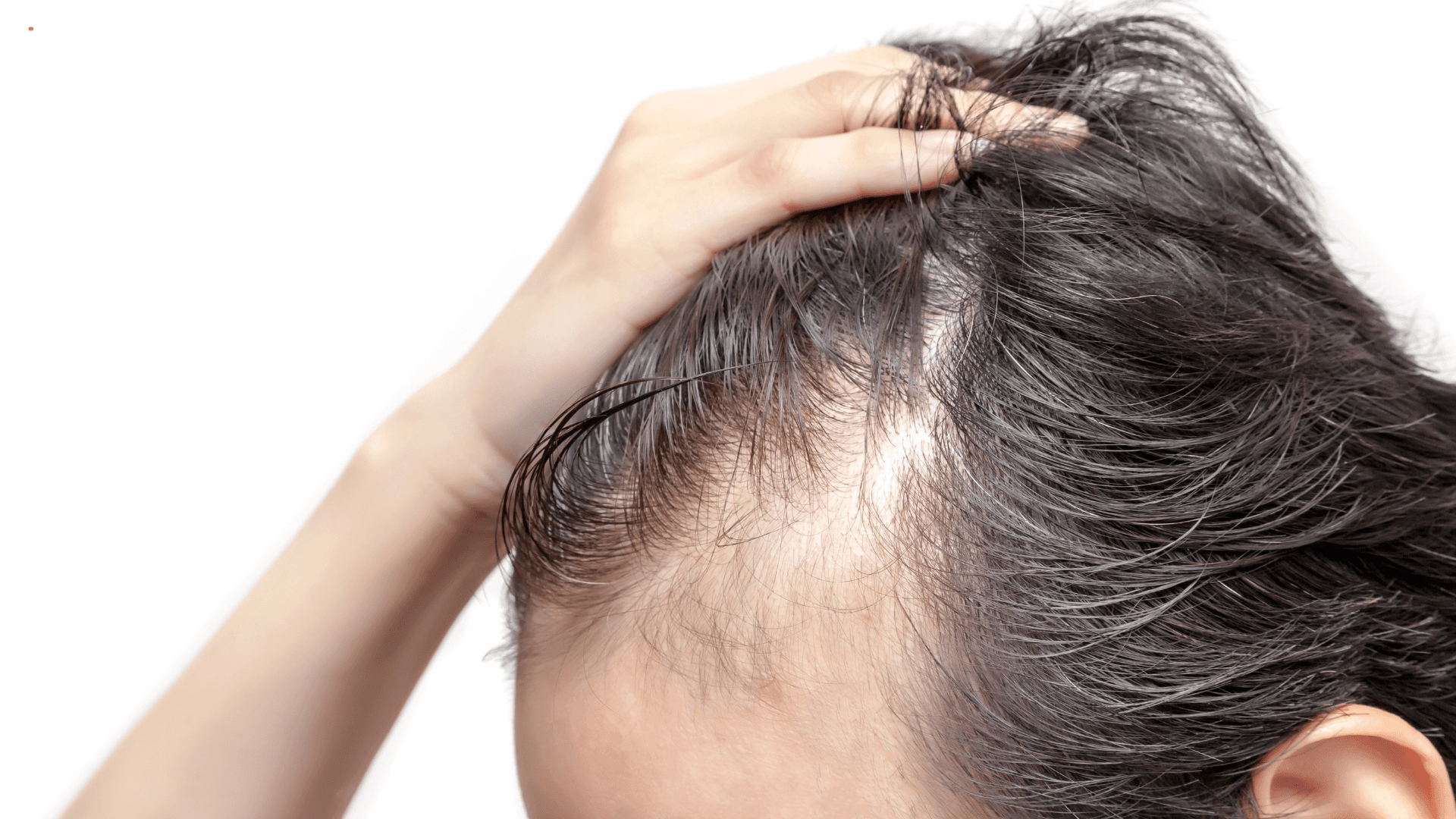 Best Foods for Hair Growth: Nutrition Tips for Stronger Hair
