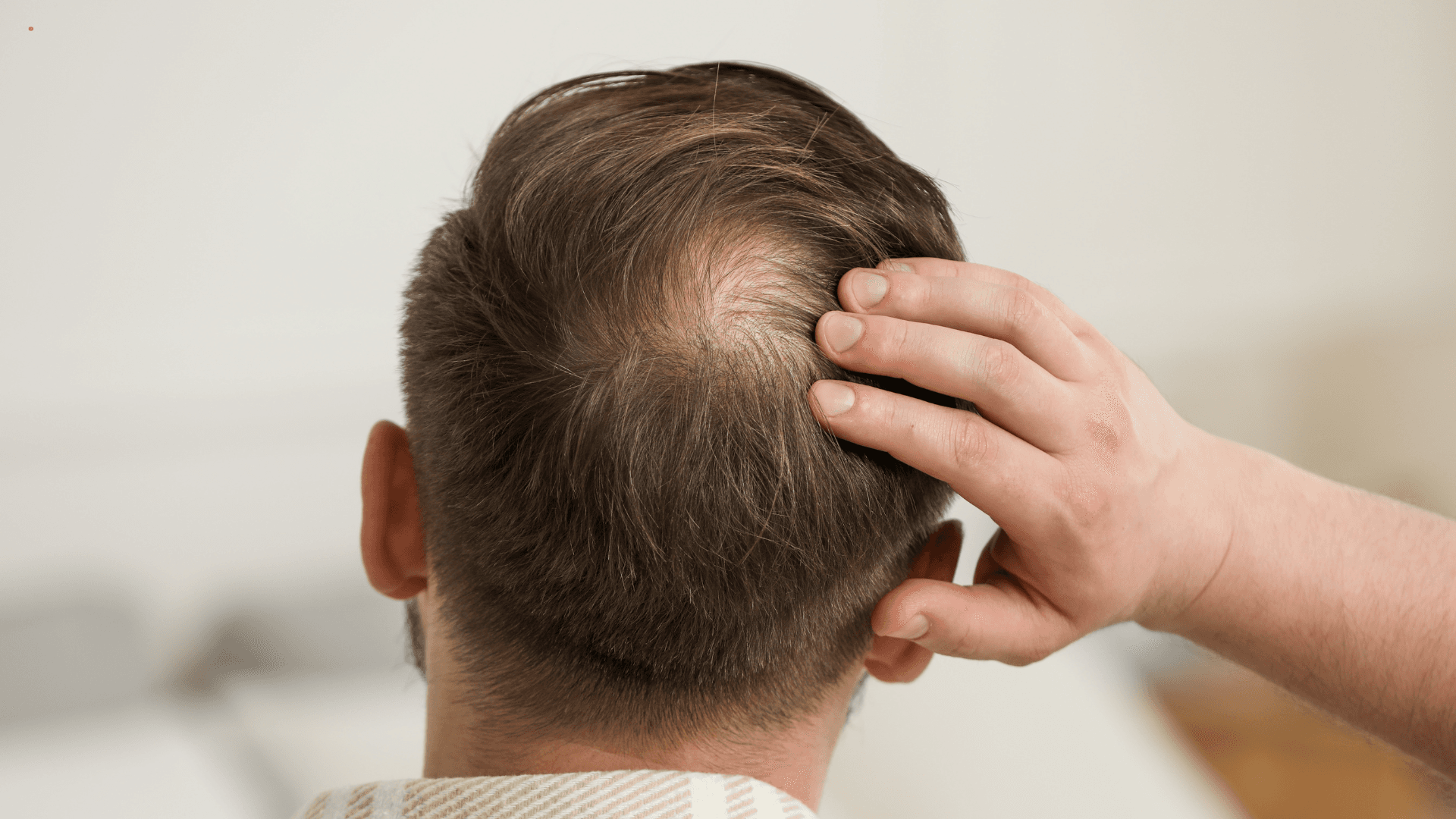 Common Myths About Hair Transplants (And the Truth)